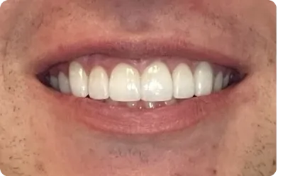 Anabela M., 34 anos