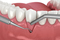 Cirugia-Periodontal
